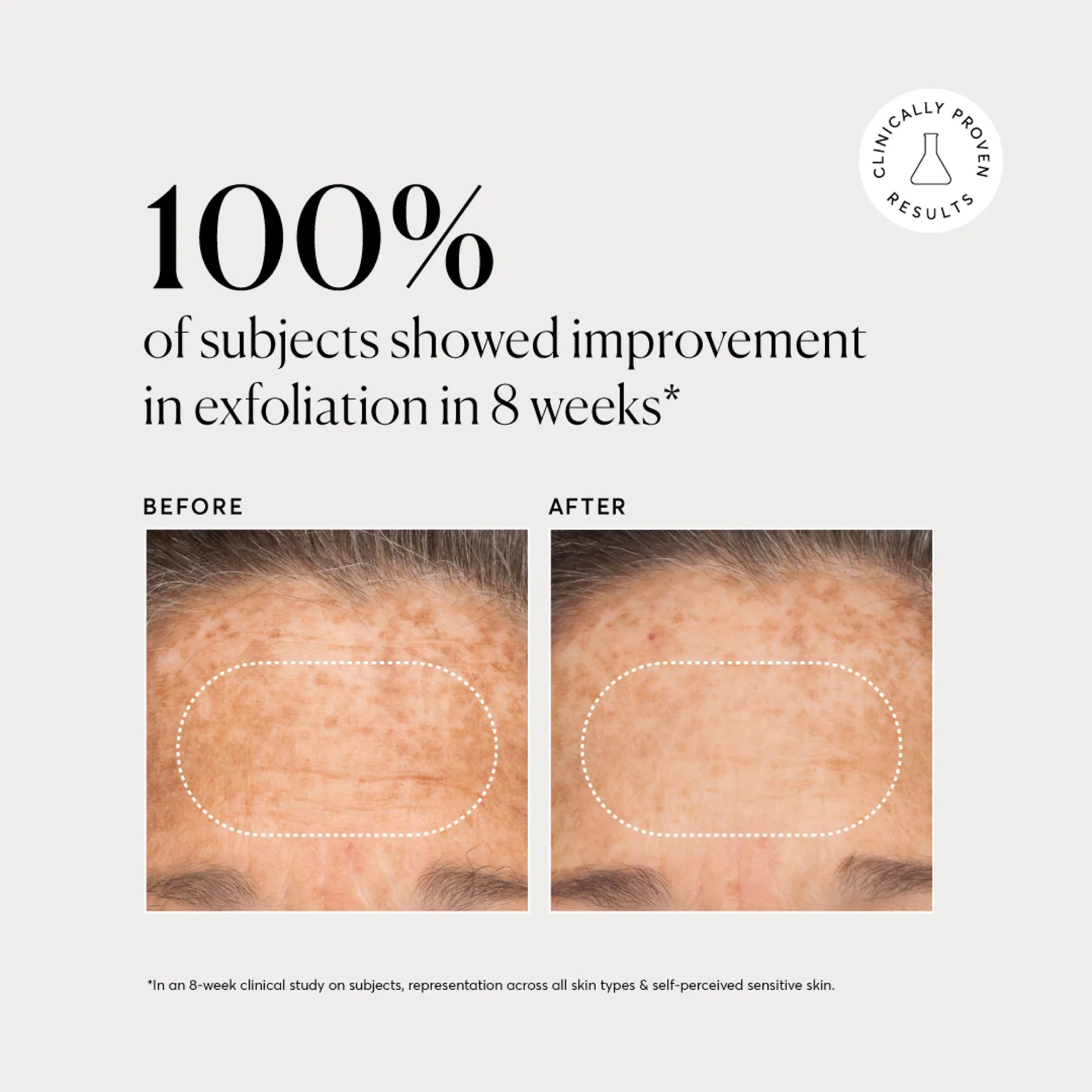 bha-liquid-exfoliant-2-h1 NATR-10027-Alt-Images-BHA-Liquid-Exfoliant-2_-03.webp
